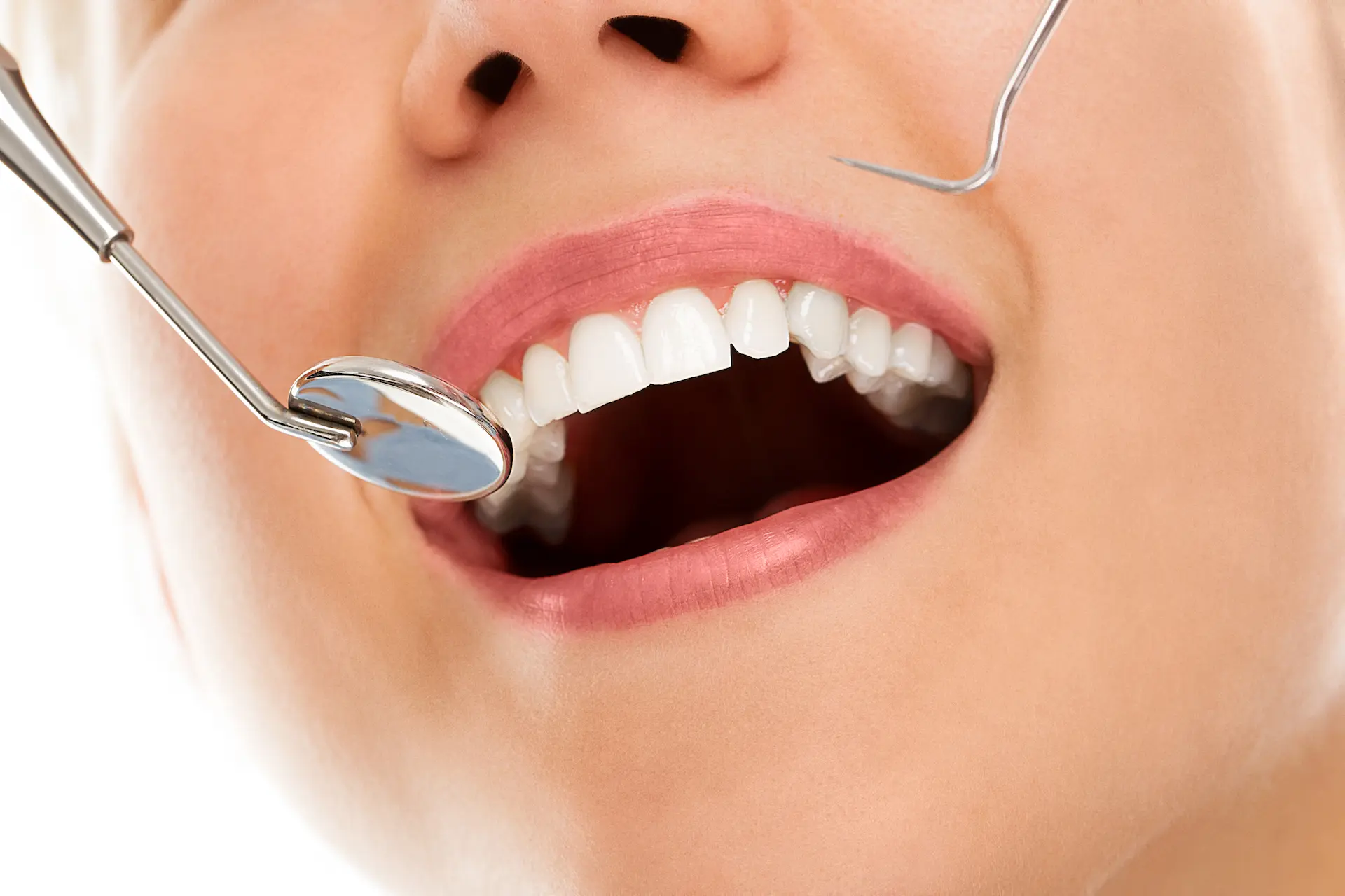 Alinhador transparente funciona? – Dental Press Portal